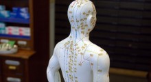 acupuntura acupuntura