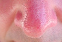 Malysheva vivir bien sobre la psoriasis