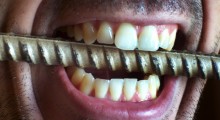 dolor-de-dientes