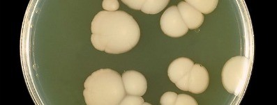 Candida albicans gracias a la Wikipedia.org Candida albicans gracias a la Wikipedia.org