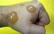 Ampolla Ampolla